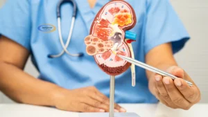 ESWL Tedavisi İyileşme Süreci